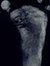 tenderfoot